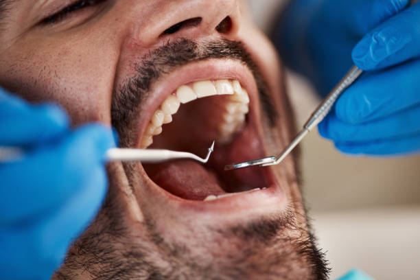 Best Walk-In Emergency Dentist in Simpson, PA