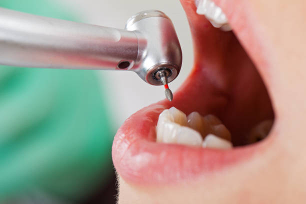 Best Emergency Tooth Extraction in Simpson, PA